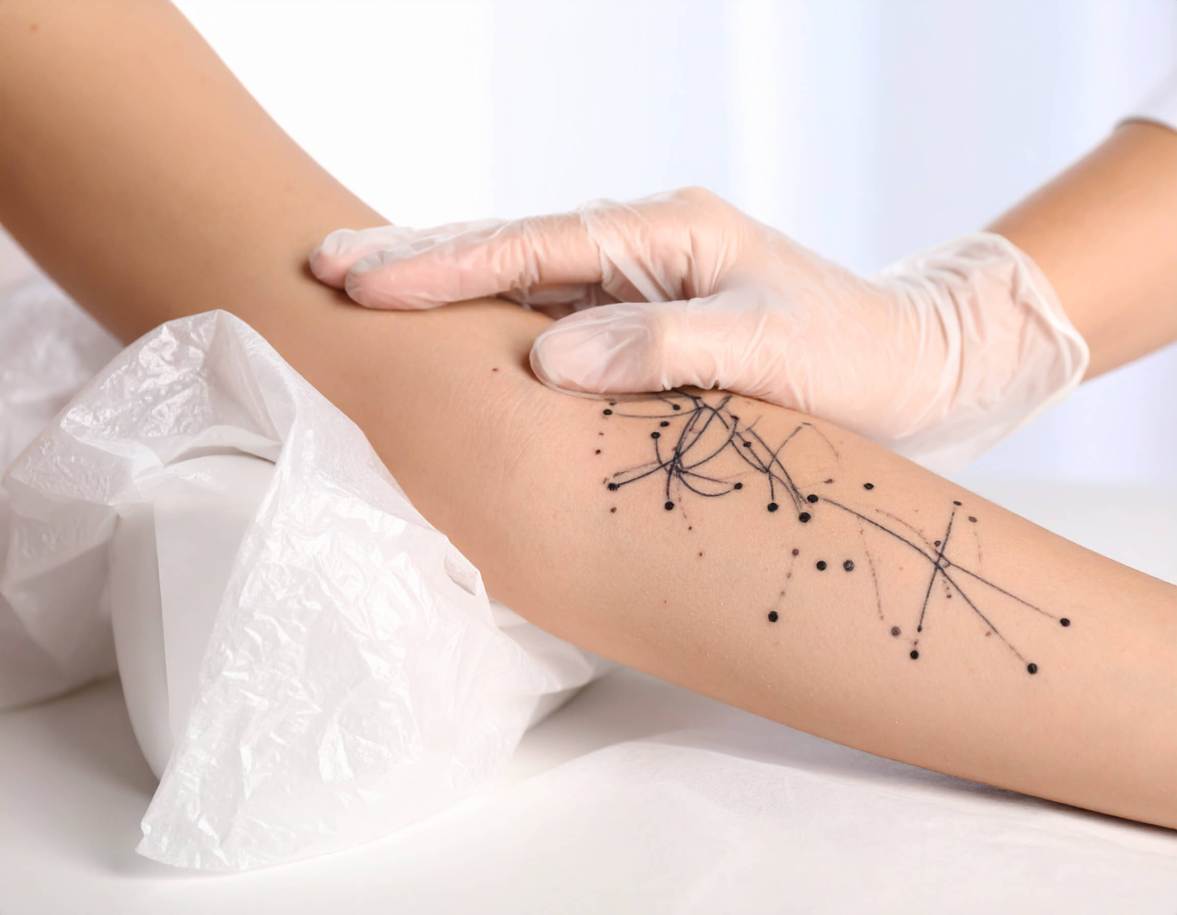 A subtle, minimalistic tattoo of dots and lines on a person's arm, freshly done